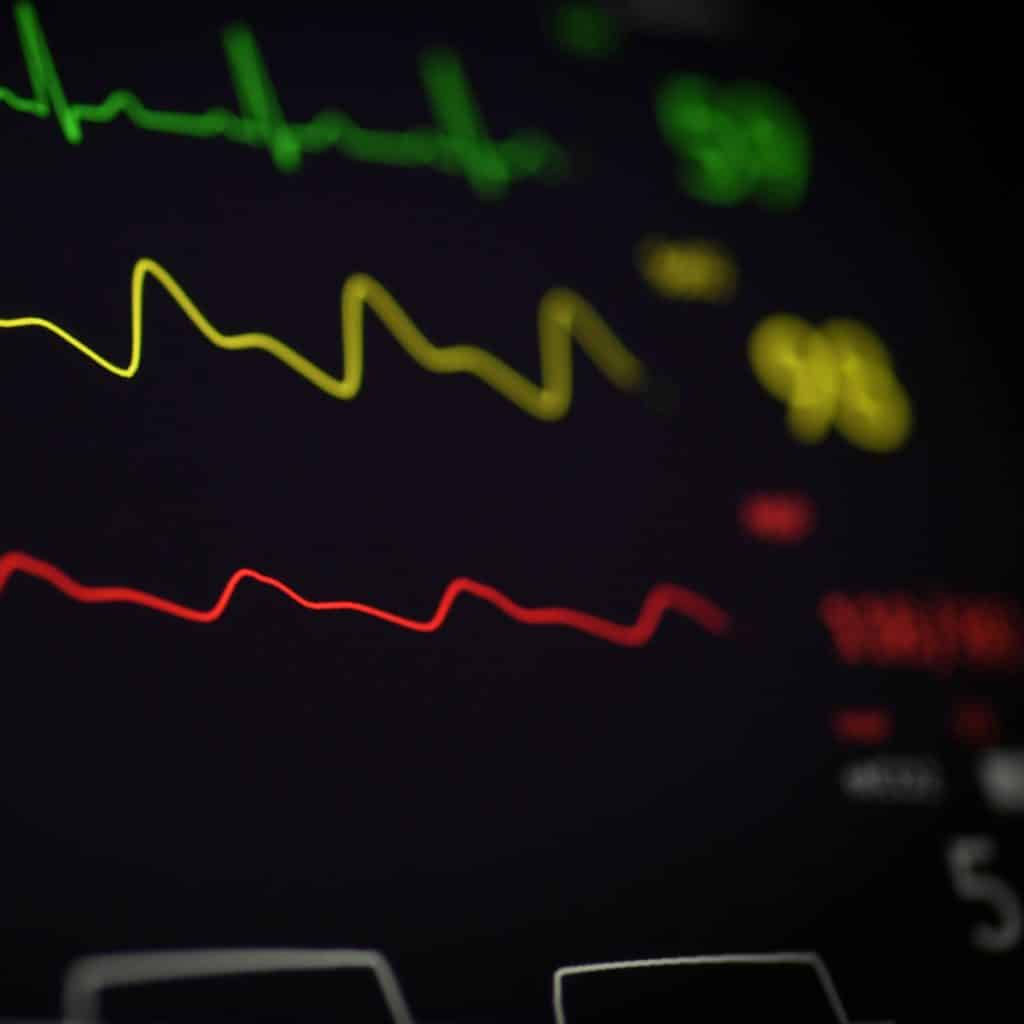 Hington Klarsey: Heart rate on monitoring screen